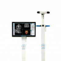 Surgical navigation Systems