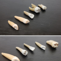 مولاژ دندان مصنوعی پالپ دار
