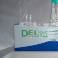 کیت استخراج ژنوم از باکتری به روش ستونی