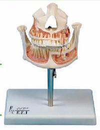 مولاژ - مدل فک بالا و پایین