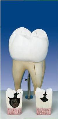 مولاژ - مدل دندان آسیا 9 تکه
