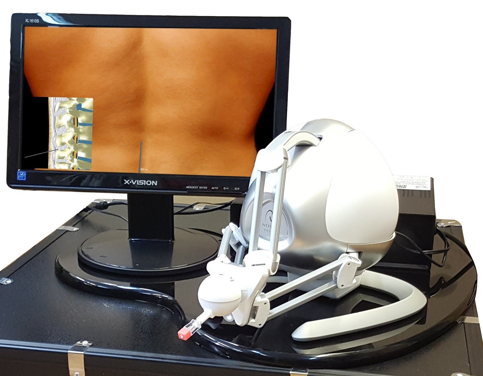 سامانه رباتیکی ارزیابی مهارت تزریقات نخاعی در محیط مجازی با حس لامسه