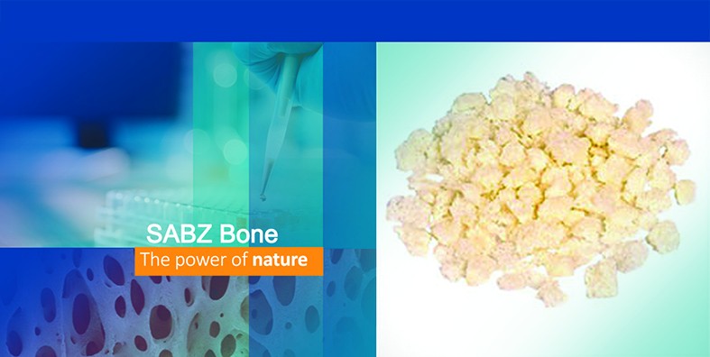 Bone Bioimplant (SABZ Bone)